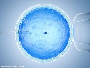 多囊卵巢案例